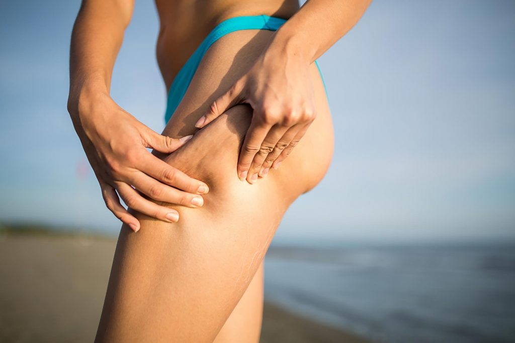 What Causes Cellulite And Why Is It Hard To Get Rid Of The Healthy