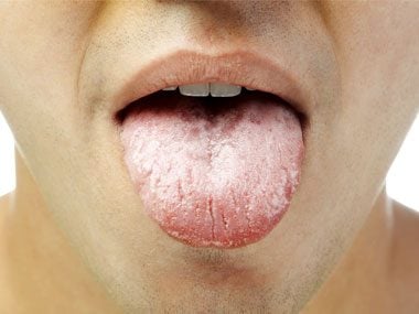 How fast does your tongue grow back?