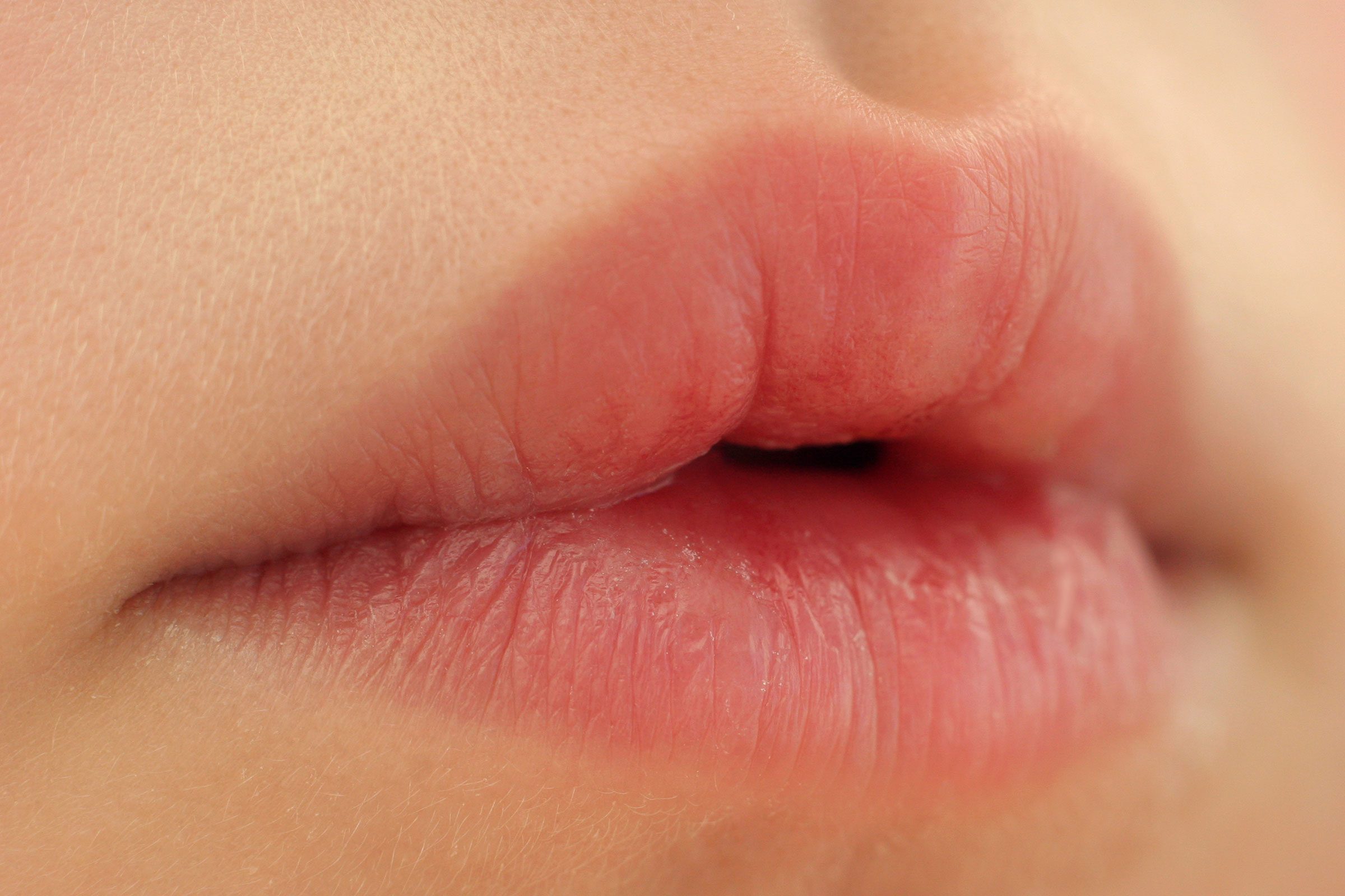 How can you treat chapped lips on a newborn?