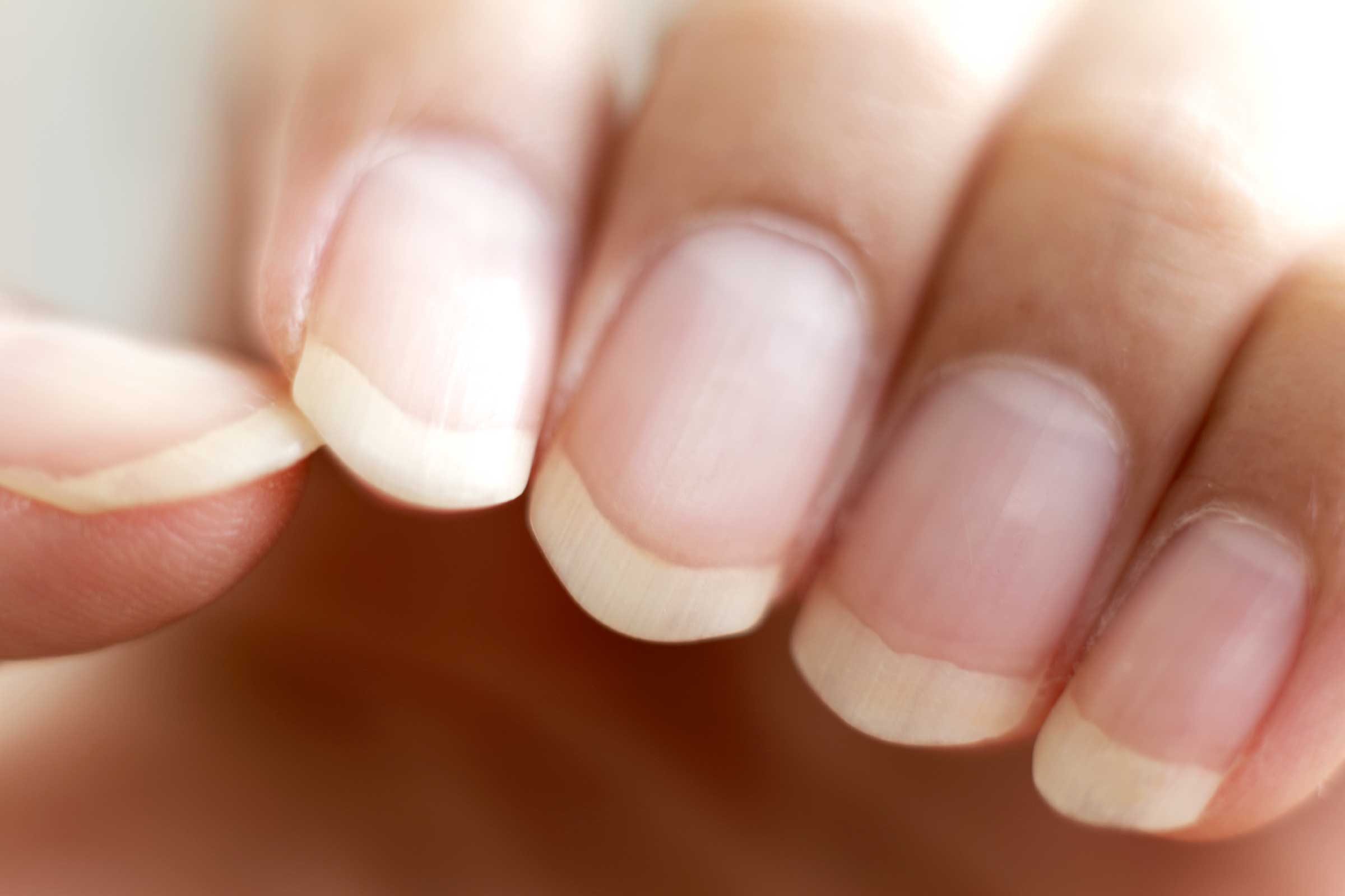 fingernails and health