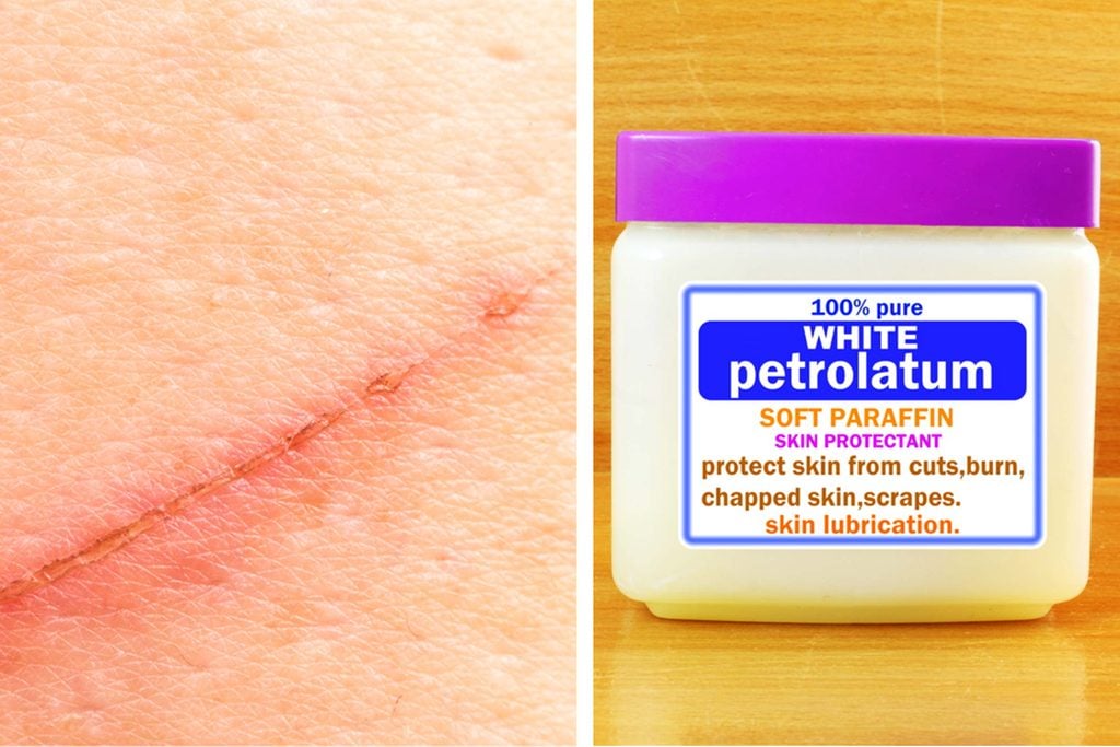 scar on skin next to a jar of petrolatum jelly