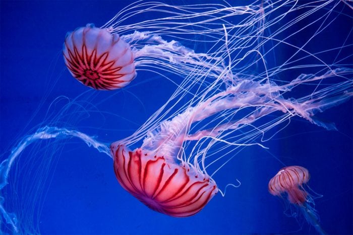 stung by jellyfish