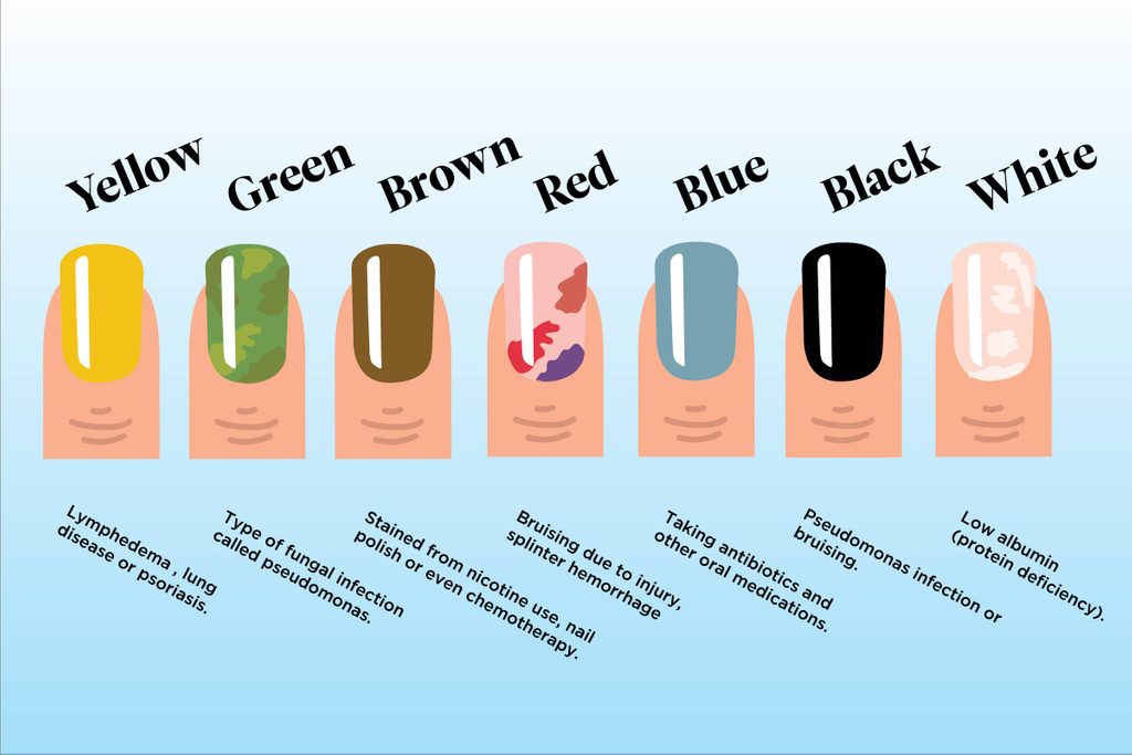 Blue nail color and medical procedures - wide 4