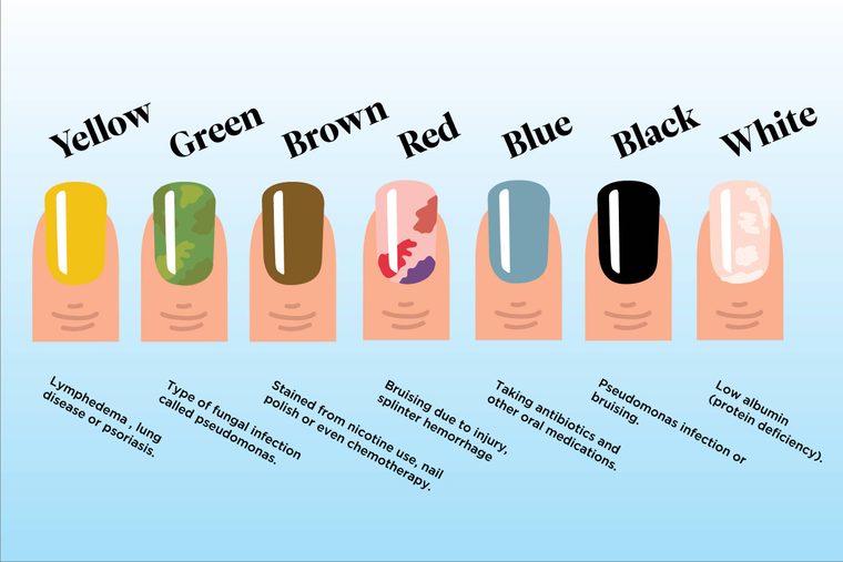 8. The Role of Genetics in Nail Color and Health - wide 3
