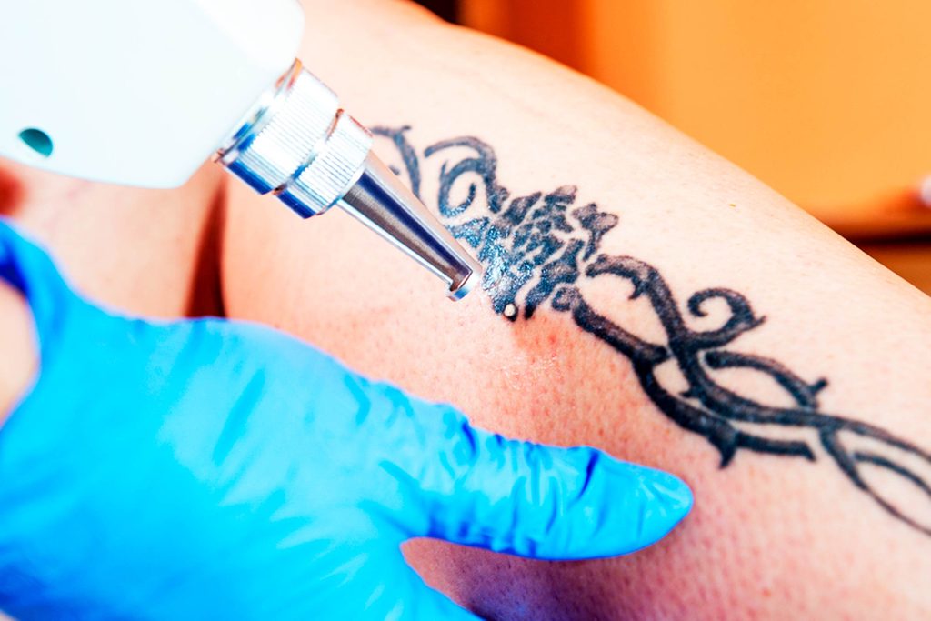The-Scary-Side-Effects-of-Tattoos-That-No-One-Is-Talking-About