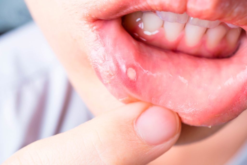 30 Everyday Mistakes That Can Cause Tooth Decay And Other