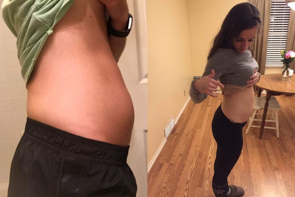 01-I-Was-So-Bloated-I-Looked-5-Months-Pregnant-Courtesy-Amber-Vesey