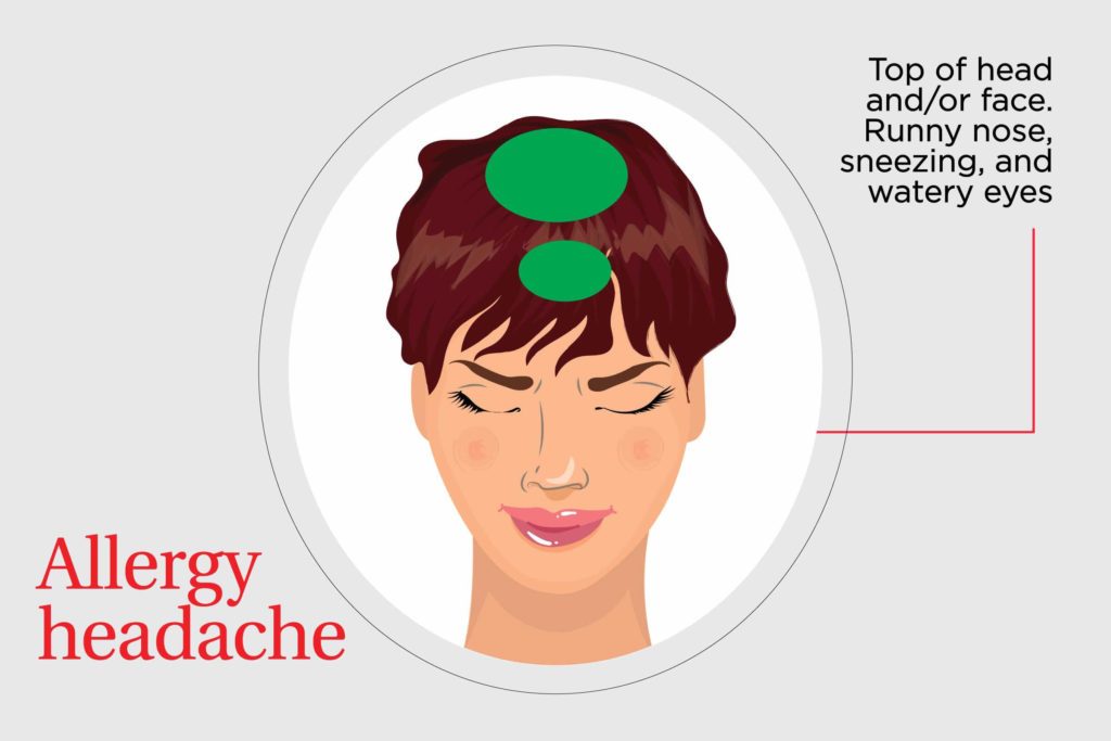 Types of Headaches—and How to Get Rid of Them | Reader's ...