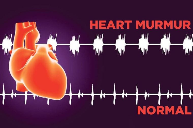 Heart-Murmur
