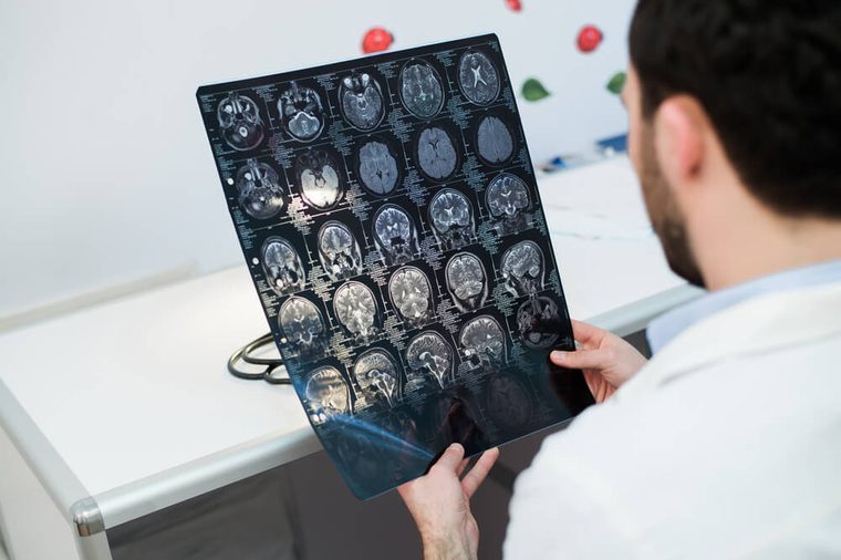 Young male physician reading and reviewing a MRI brain scan