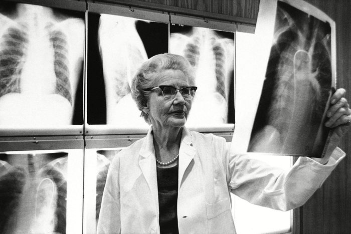 Dr. Helen B. Taussig, co-developer of the blue baby operation, examines an X-ray at Johns Hopkins Hospital in Baltimore, where she is still active at the age of 69. She believes heart transplants one day may save infants born with severely malformed hearts
