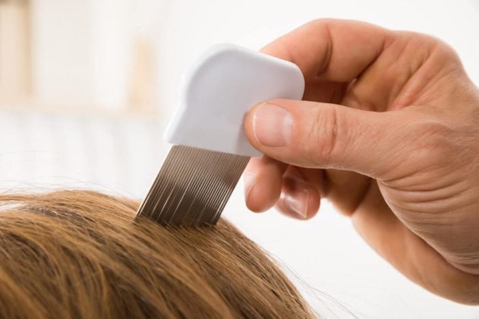 Close-up Of Person Hand Using Lice Comb On Patient's Hair