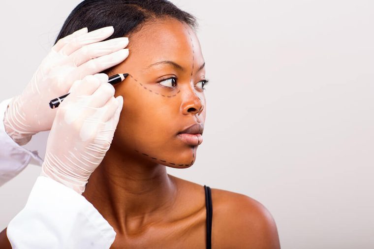 doctor marking young african woman face for plastic surgery
