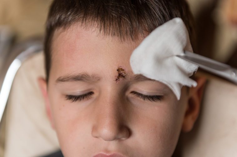 Young boy with injured forehead. Wound curing treatment