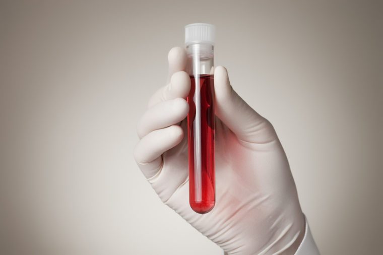 Doctor holding a bottle of blood sample