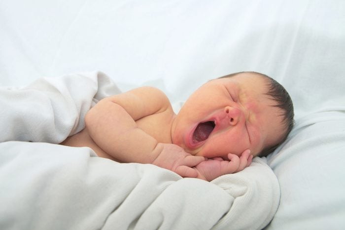 funny baby face,newborn with jaundice on white blanket, infant health care concept