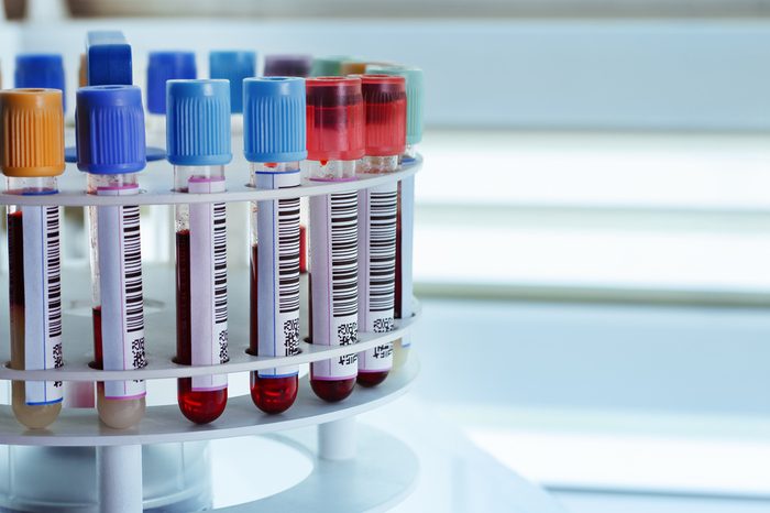 tubes prepared in lab centrifuge machine blood bank
