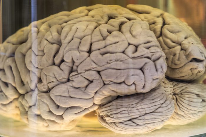 Human brain in a jar (real specimen)