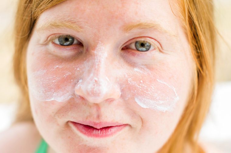 Young redheaded and freckled woman with sunscreen on her face and cheeks.