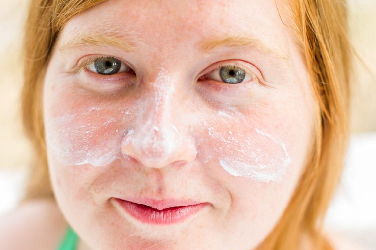 Young redheaded and freckled woman with sunscreen on her face and cheeks.