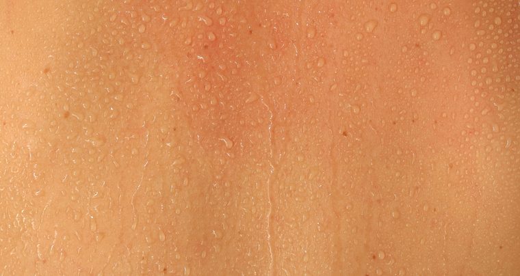Human Skin and Sweat