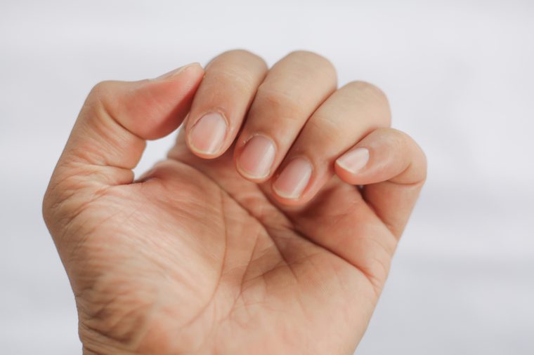  closeup of man finger nail 
