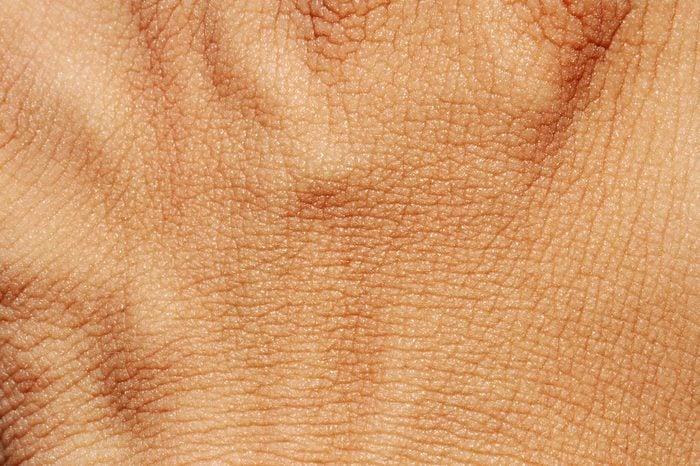 human skin texture