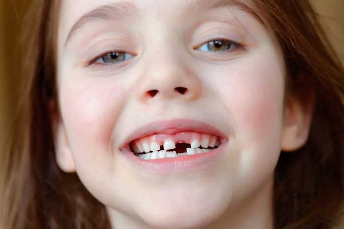 The adorable girl smiles with the fall of the first baby teeth