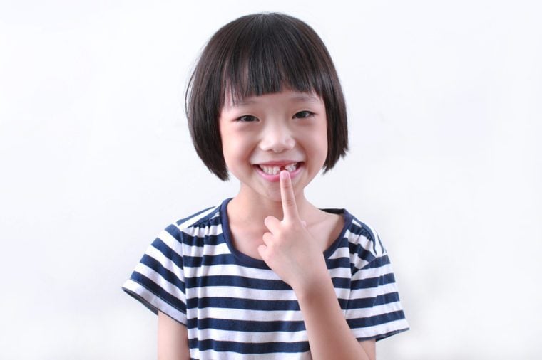 Cute asian girl missing front tooth pointing at it with her finger