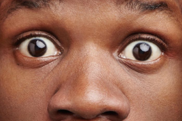 Close up portrait of bug eyed stupefied black man keeps hands on head, stares at camera, realizes that he forgot to pay bills, poses against pink studio background. Emotions and lifestyle concept