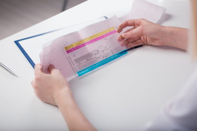 Doctor keeps in the hands of a cardiogram, holds her transcript. The image depth of field.