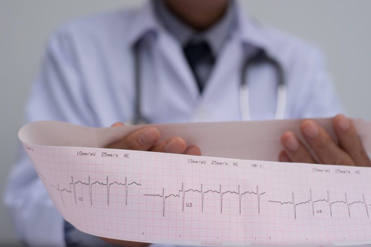 청진기를 들고 심장 질환 환자의 심전도 종이 인쇄 보고서를 읽고 흰색 코트에 남성 심장 의사 또는 의료 학생의 닫습니다