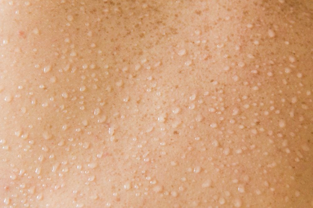Skin Problems That Could Be A Sign Of Serious Disease The Healthy