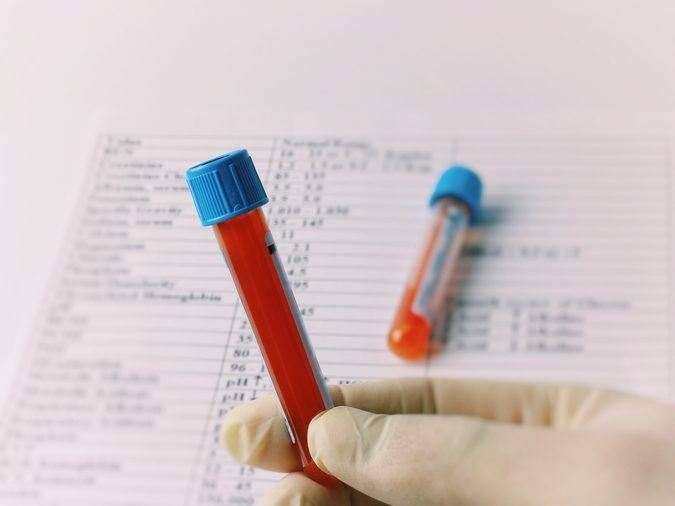 Hematology blood analysis report. Test tubes with blood, a lab technician in gloves holds in his hand.