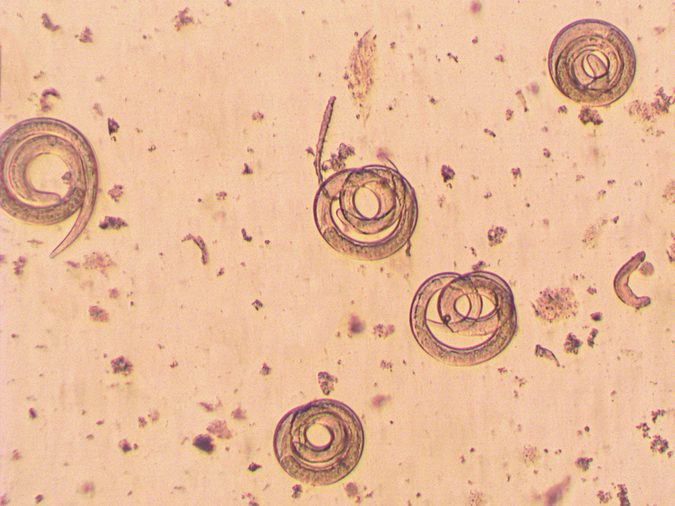 Trichinella spiralis - parasitic worm microscope