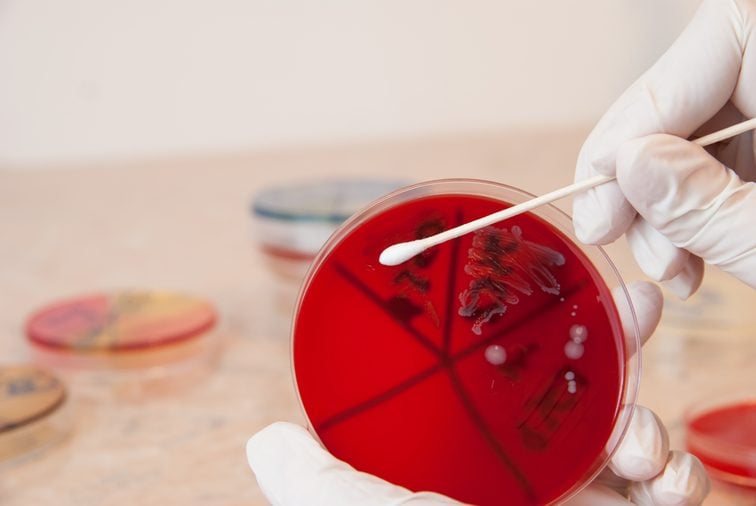 Scientist with sterile swab retrieving Streptococcus bacteria from Columbia blood agar petri dish