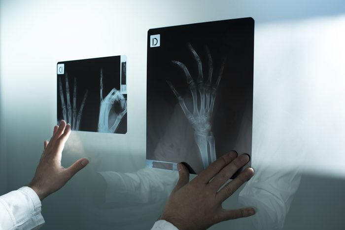 Examining the x ray of two hands