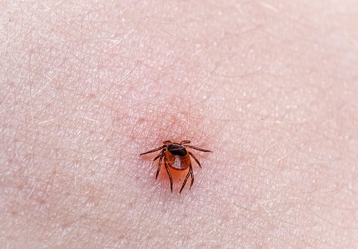 Tick Ixodes ricinus on human skin. tick wandering over human hand. Encephalitis tick. This kind of animal is a spreader of borrelia and tbe.