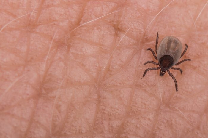 Small deer tick on human skin close-up. Ixodes ricinus. Dangerous biting parasite on detail of the epidermis with light hairs. It carries encephalitis, Lyme borreliosis, babesiosis and ehrlichiosis.