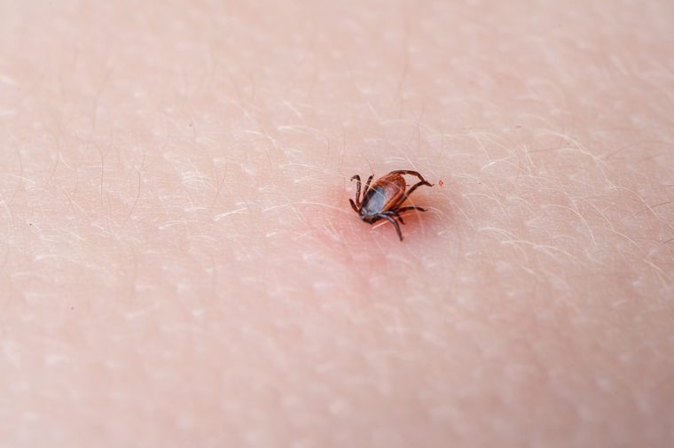 Tick Ixodes ricinus on human skin. tick wandering over human hand. Encephalitis tick. This kind of animal is a spreader of borrelia and tbe.