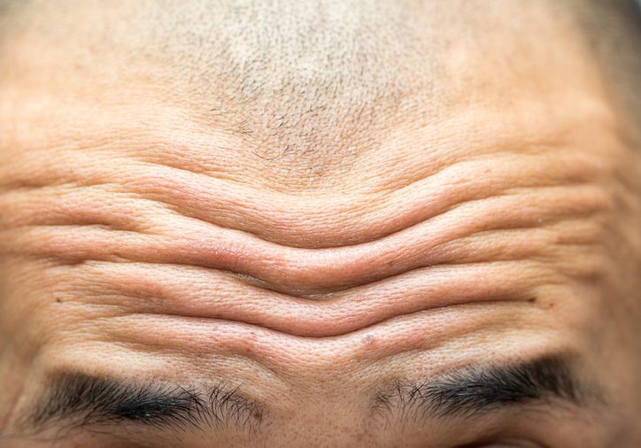 close-up on wrinkled forehead