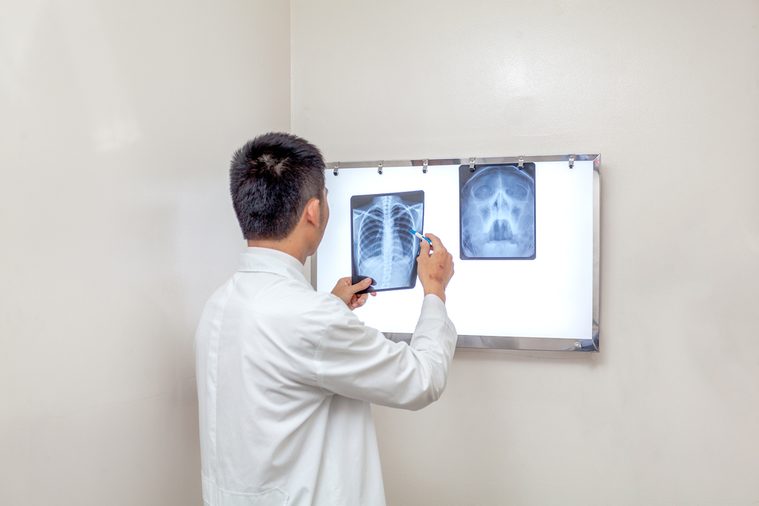 X-ray, X-ray Image, Doctor at Ho Chi Minh city, Vietnam
