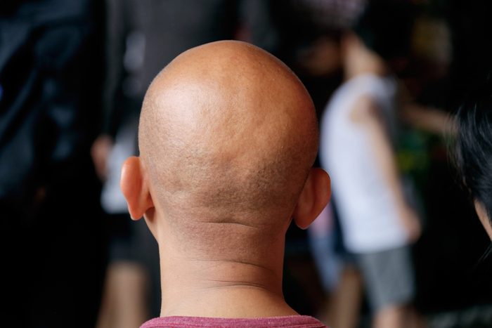 Bald man : Asian bald man looking from behind