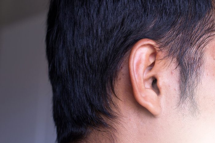 Earwax in ear close up,Healthcare concept,Selective focus