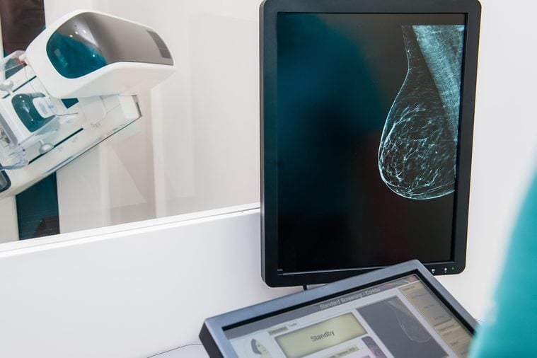 Mammogram snapshot of breasts of a female patient on the monitor with undergoing mammography test on the background. Selective focus