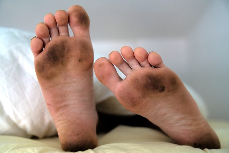 Dirty bare feet of a sleeping person showing out of the blanket on a bed