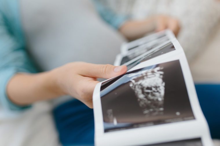 Pregnant woman sitting in the bedroom and looking at the print of her ultrasound baby results