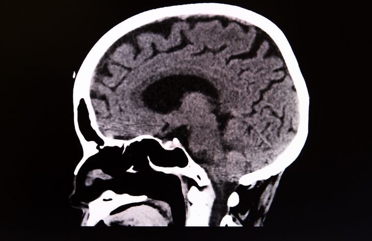 Transverse view of CT scan of head and neck showing normal structures of organs