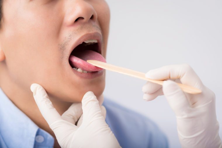 Close-up image of male patient having check-up of his throat