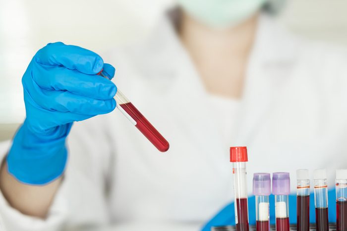 Female Technician holding blood tube test, a rack of blood samples Tubes of patients in laboratory in the hospital.